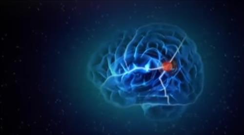 The Brain that Changes Itself Documentary step 1